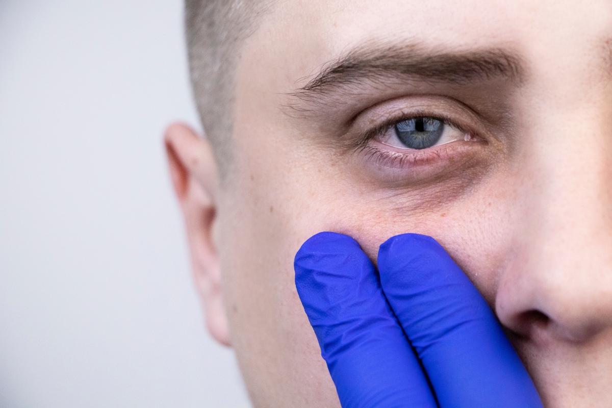 Quais os tratamentos estéticos disponíveis para olheiras escuras em homens?